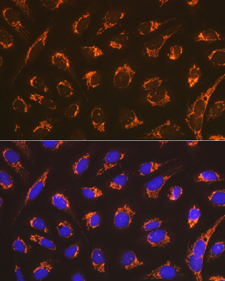 Smac/Diablo Rabbit mAb