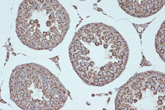 Smac/Diablo Rabbit mAb