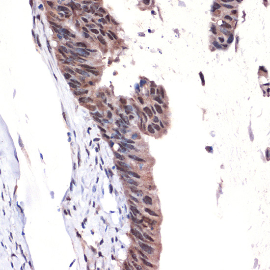 MBD3 Rabbit mAb
