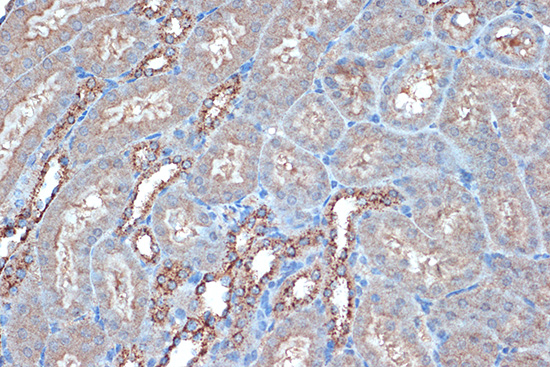 Raptor Rabbit mAb