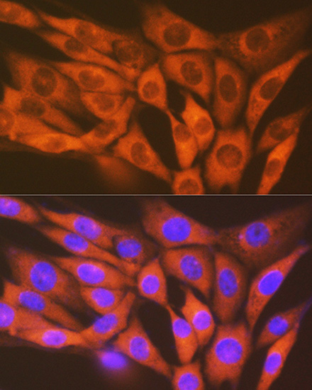 STK3/MST2 Rabbit mAb