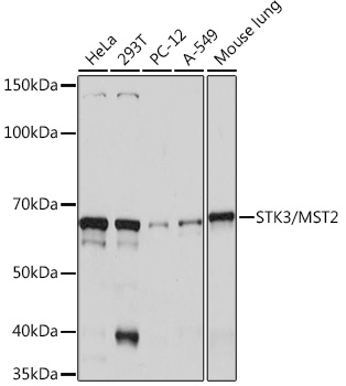 STK3/MST2 Rabbit mAb