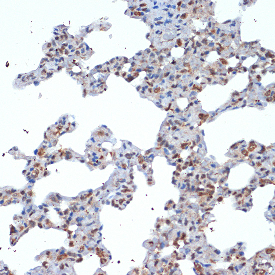 SOCS2 Rabbit mAb