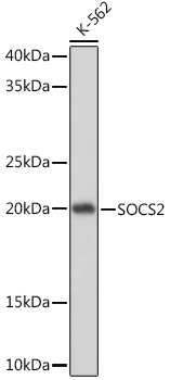SOCS2 Rabbit mAb