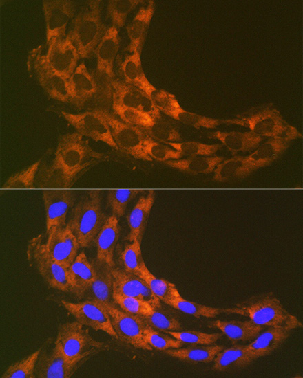 RPS20 Rabbit mAb