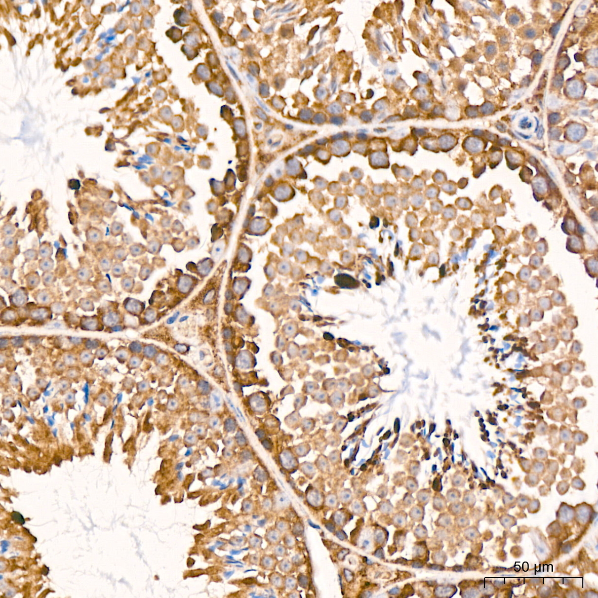 RPS20 Rabbit mAb
