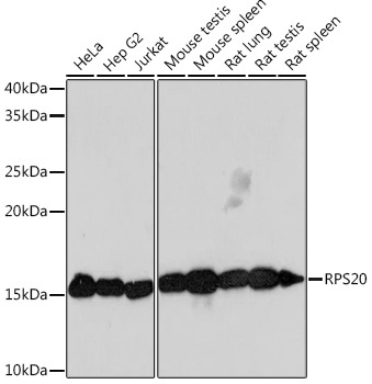 RPS20 Rabbit mAb
