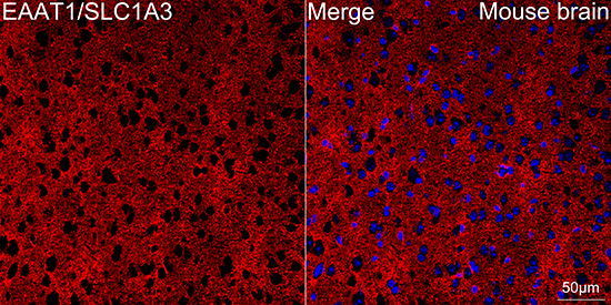 EAAT1/SLC1A3 Rabbit mAb