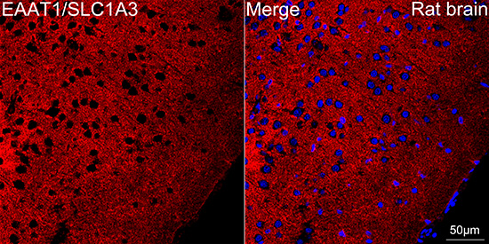 EAAT1/SLC1A3 Rabbit mAb