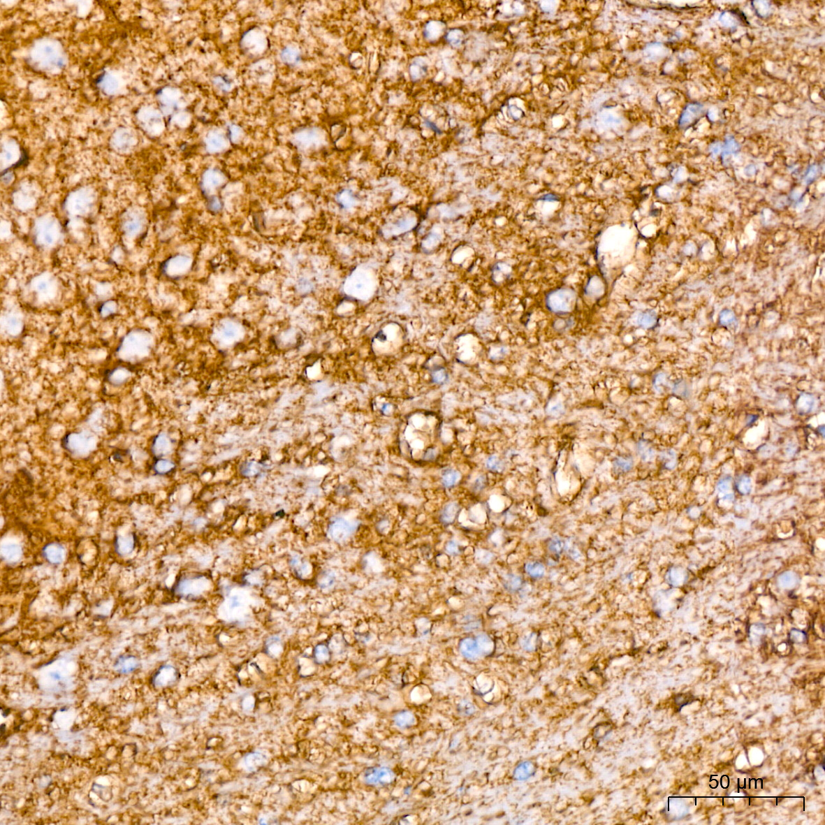 EAAT1/SLC1A3 Rabbit mAb