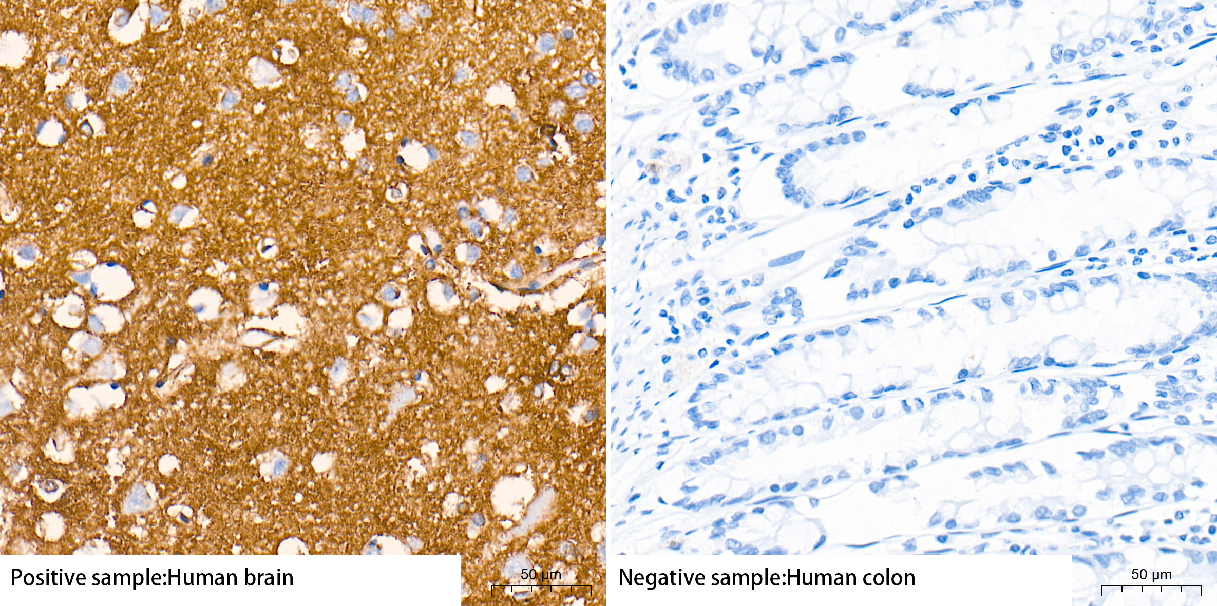 EAAT1/SLC1A3 Rabbit mAb