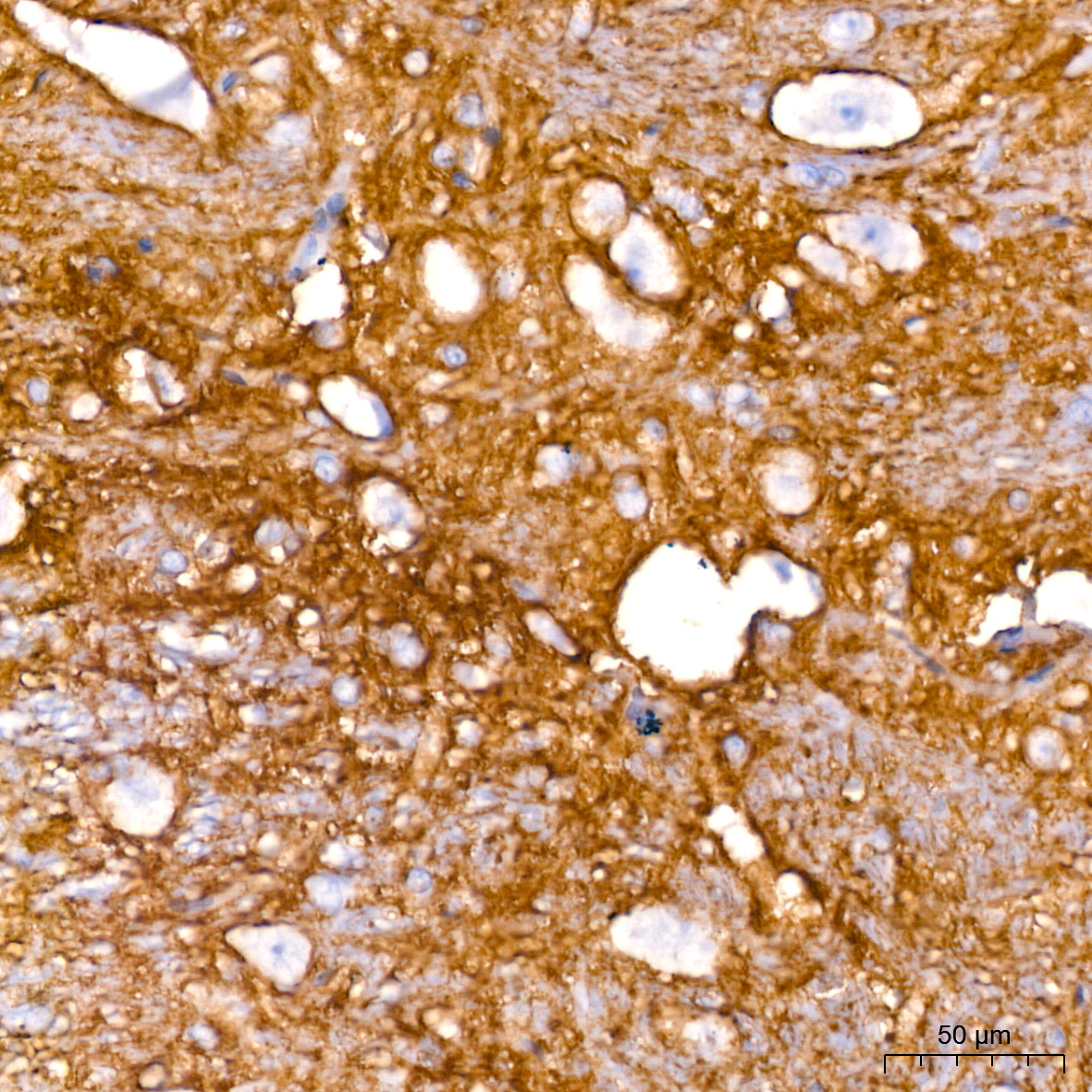 EAAT1/SLC1A3 Rabbit mAb
