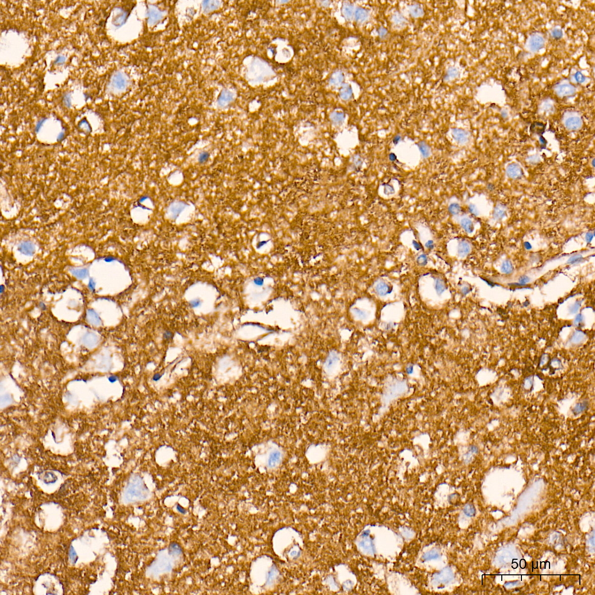 EAAT1/SLC1A3 Rabbit mAb