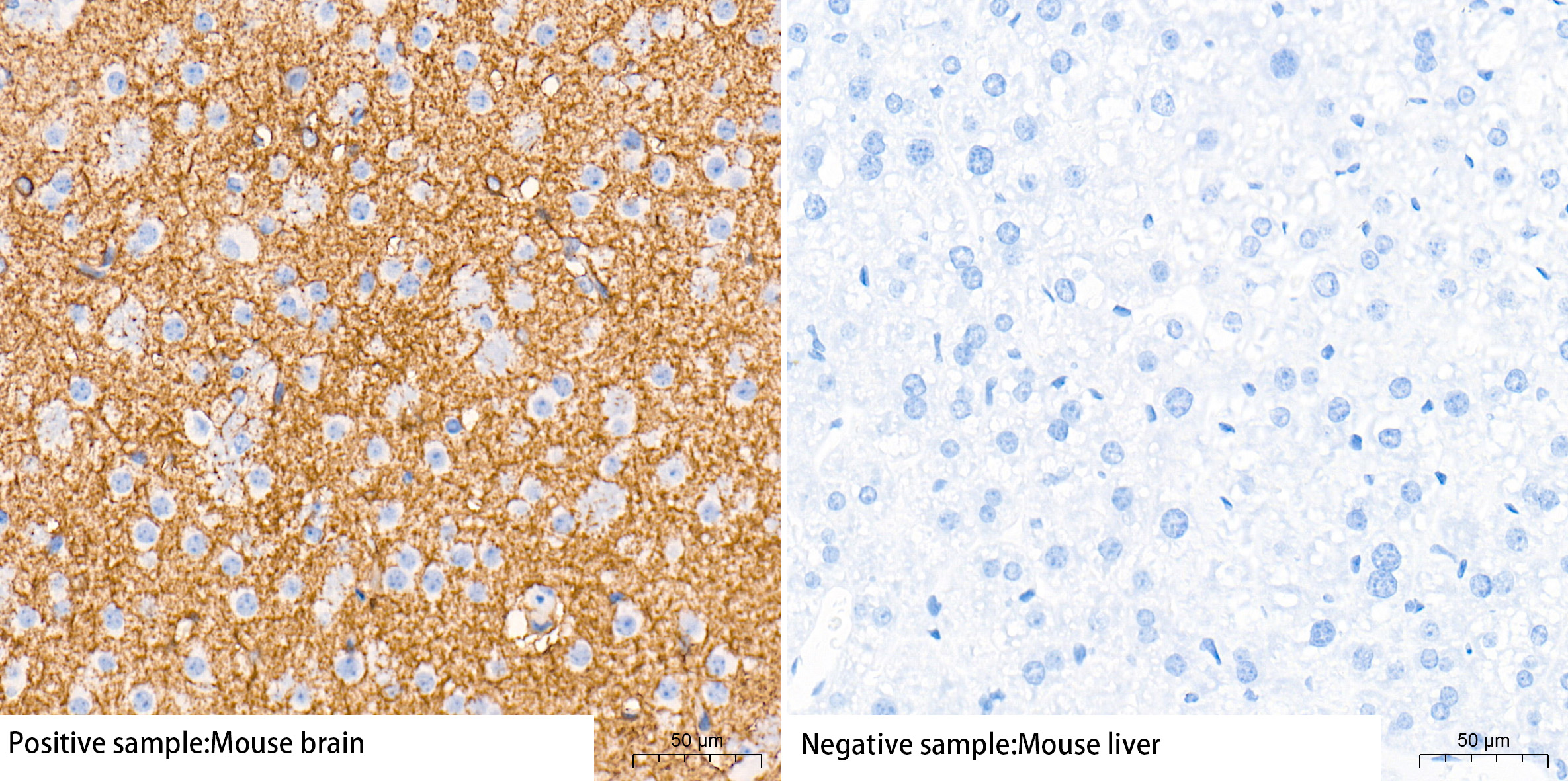 EAAT1/SLC1A3 Rabbit mAb