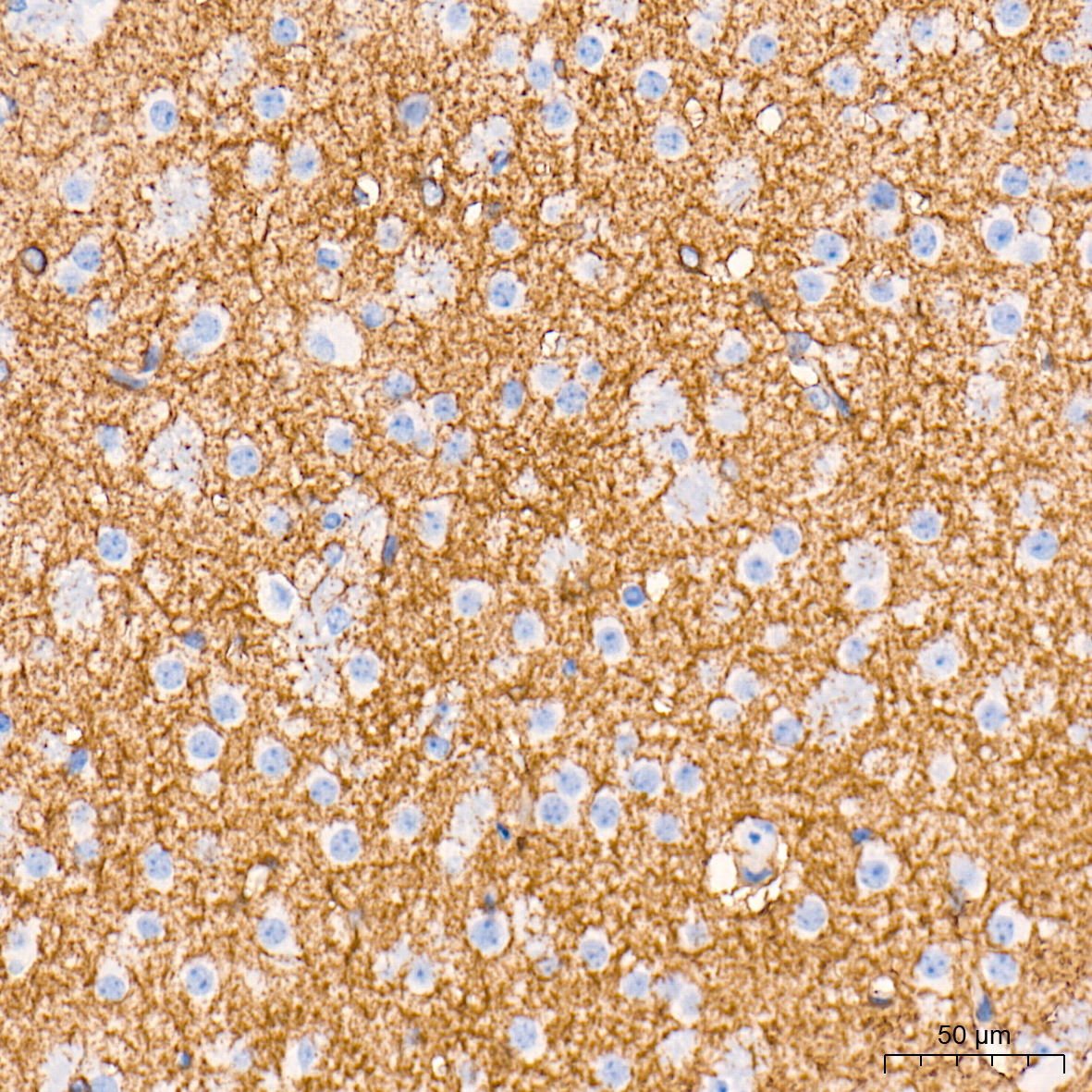 EAAT1/SLC1A3 Rabbit mAb