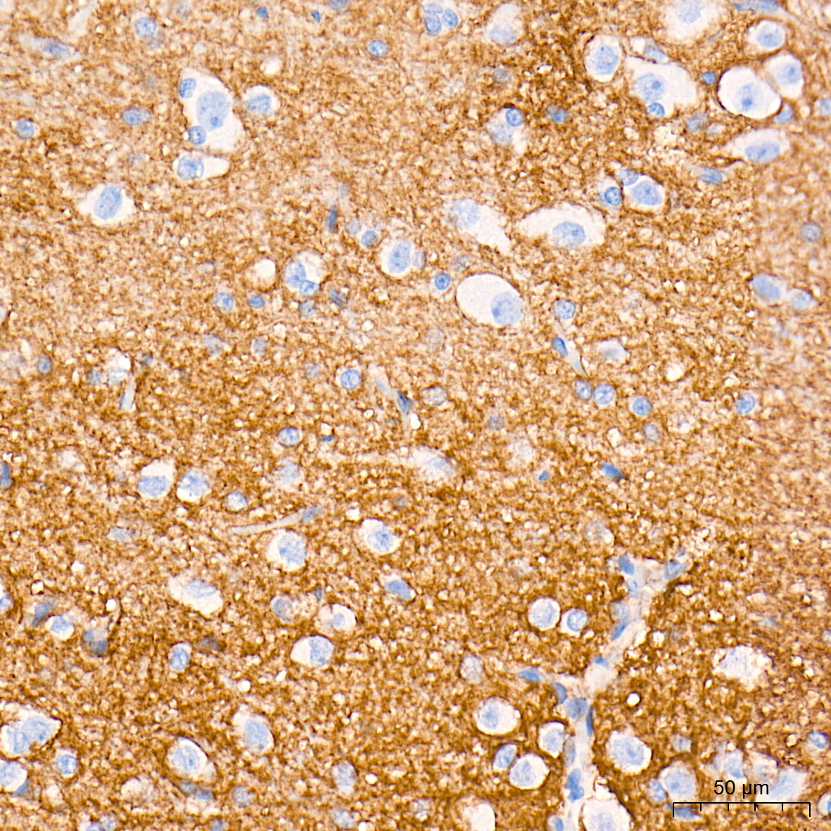 EAAT1/SLC1A3 Rabbit mAb