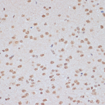 Phospho-AMPKα1-T183/AMPKα2-T172 Rabbit pAb