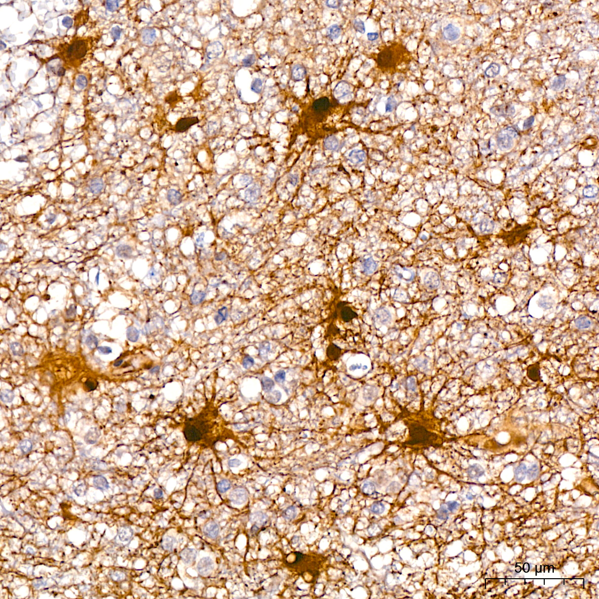 Phospho-ERK1-T202 + ERK2-T185 Rabbit mAb
