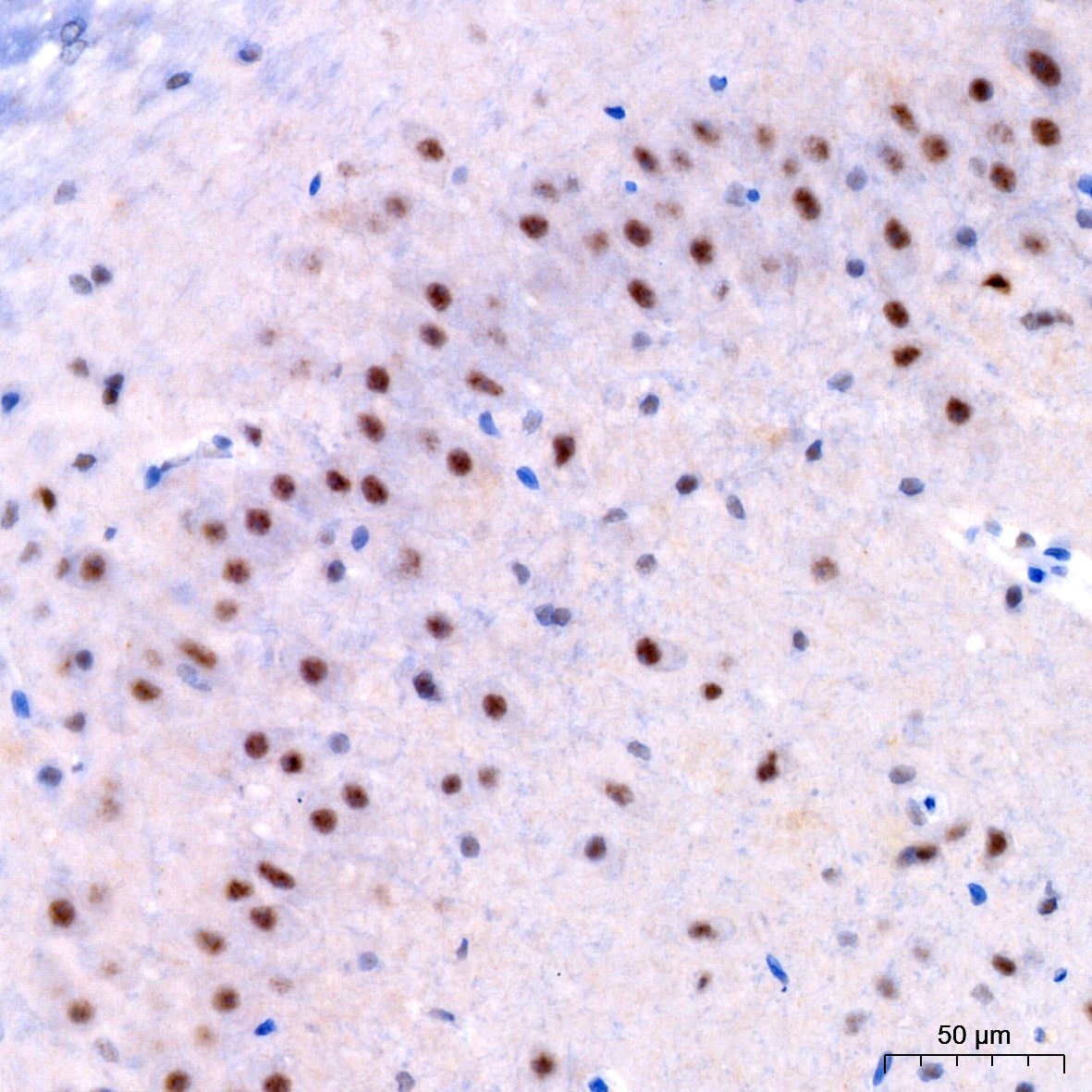 Phospho-ERK1-T202 + ERK2-T185 Rabbit mAb