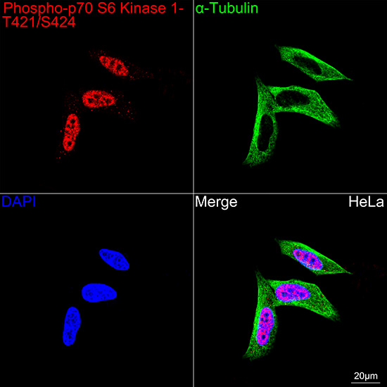 Phospho-p70 S6 Kinase 1-T421/S424 Rabbit mAb