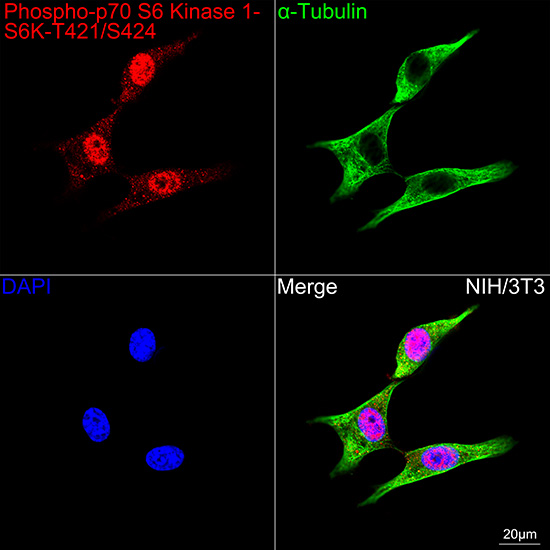 Phospho-p70 S6 Kinase 1-T421/S424 Rabbit mAb