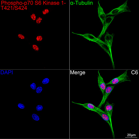 Phospho-p70 S6 Kinase 1-T421/S424 Rabbit mAb