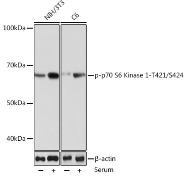Phospho-p70 S6 Kinase 1-T421/S424 Rabbit mAb