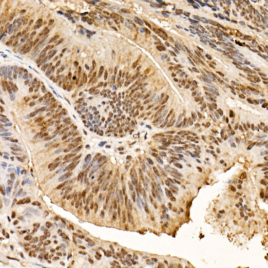 Phospho-AKT-S473 Rabbit mAb
