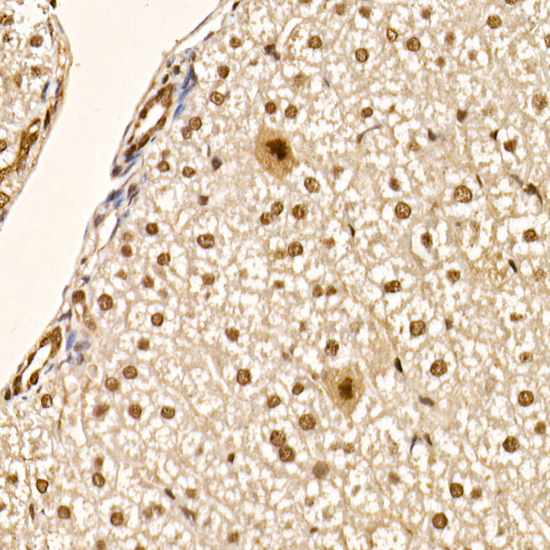 Phospho-AKT-S473 Rabbit mAb