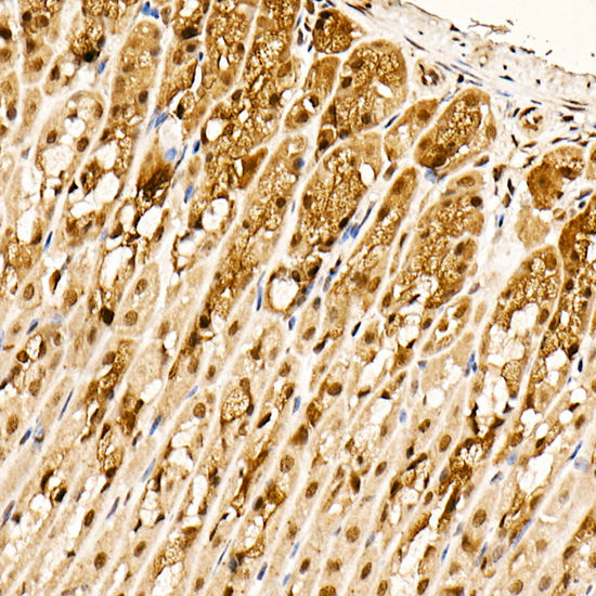 Phospho-AKT-S473 Rabbit mAb