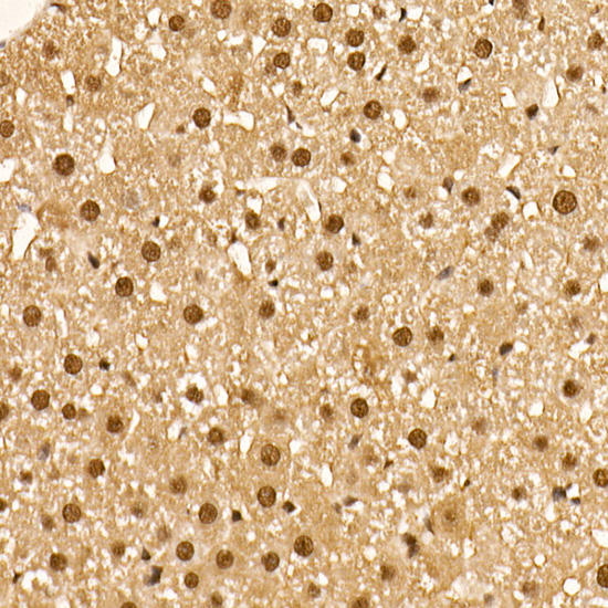 Phospho-AKT-S473 Rabbit mAb