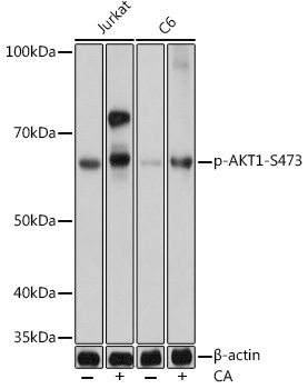 Phospho-AKT-S473 Rabbit mAb