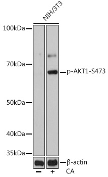 Phospho-AKT-S473 Rabbit mAb