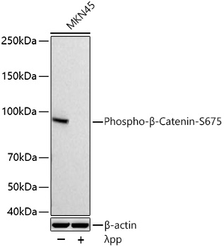 Phospho-β-Catenin-S675 Rabbit pAb