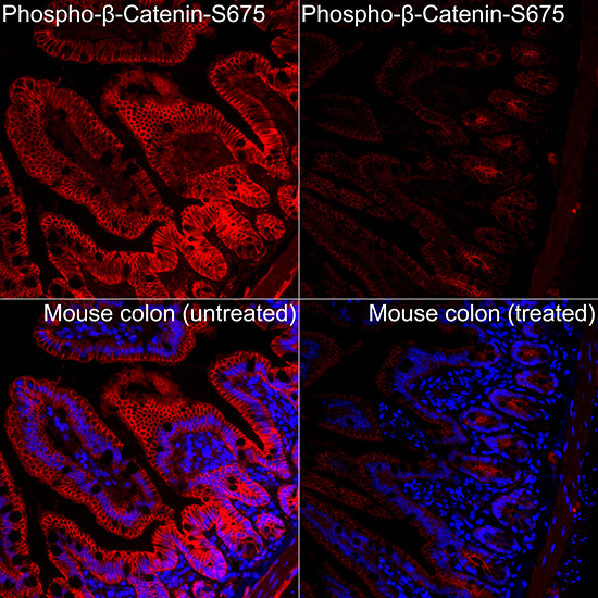 Phospho-β-Catenin-S675 Rabbit pAb