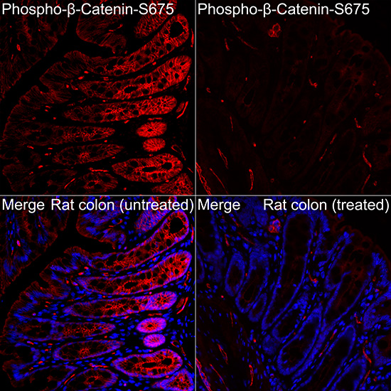 Phospho-β-Catenin-S675 Rabbit pAb