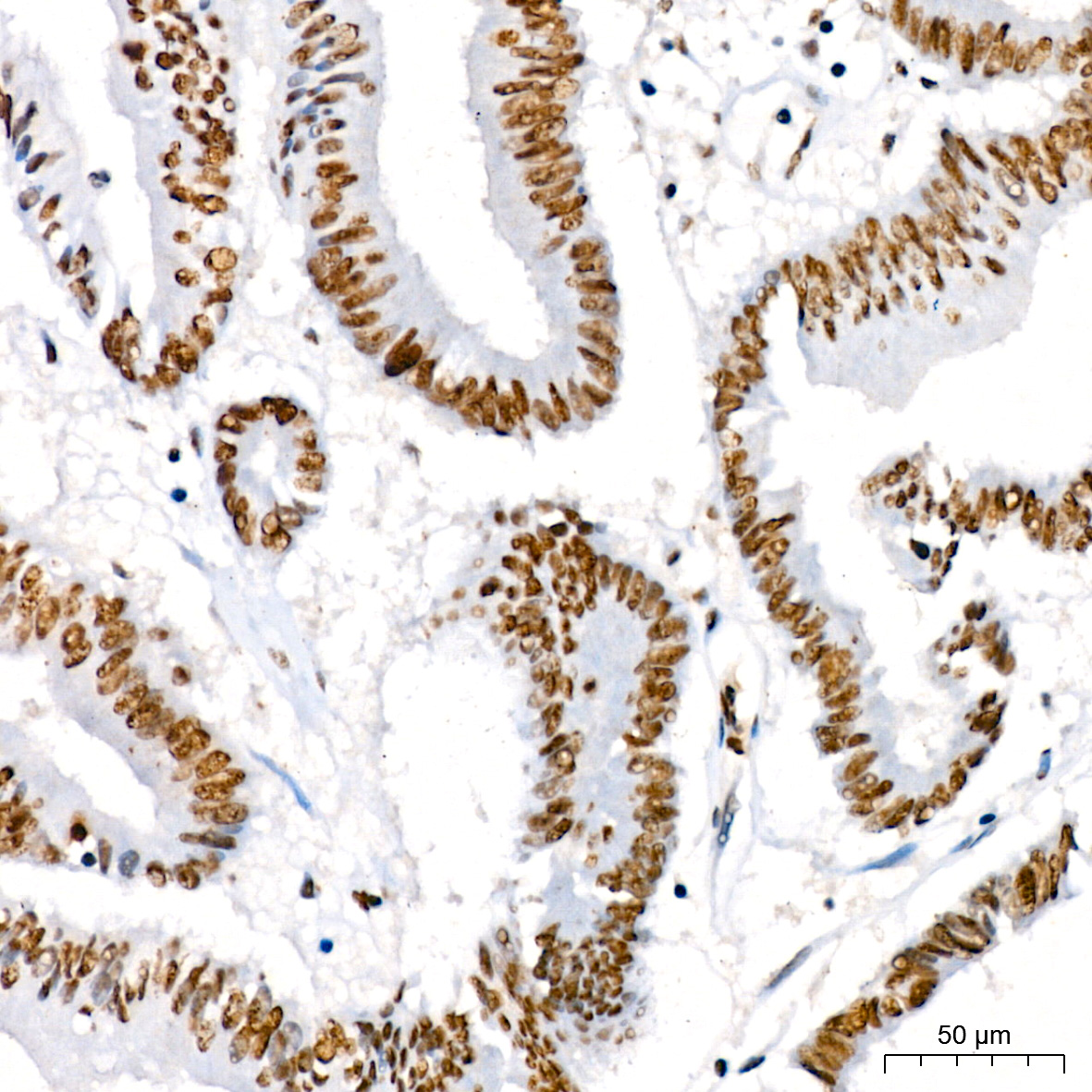 Phospho-IκBα-S36 Rabbit mAb