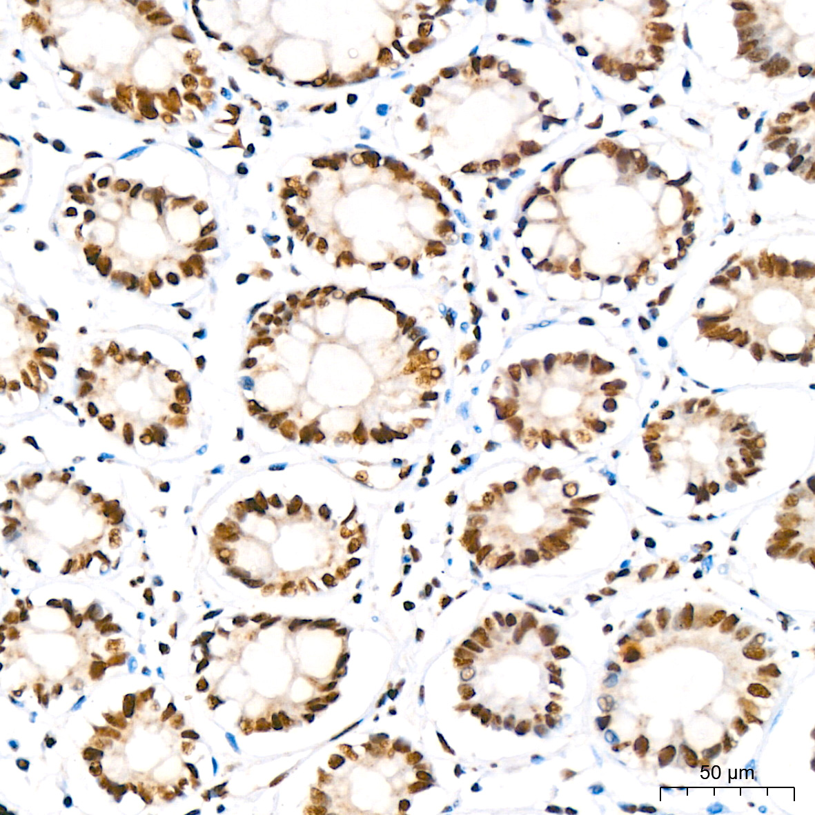 Phospho-IκBα-S36 Rabbit mAb