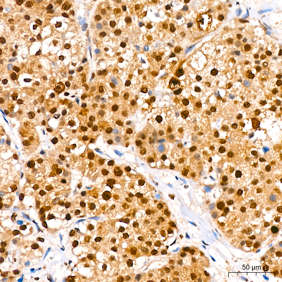 Phospho-IκBα-S36 Rabbit mAb