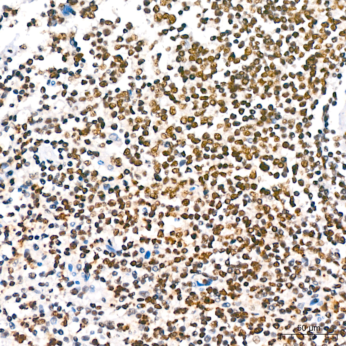 Phospho-IκBα-S36 Rabbit mAb