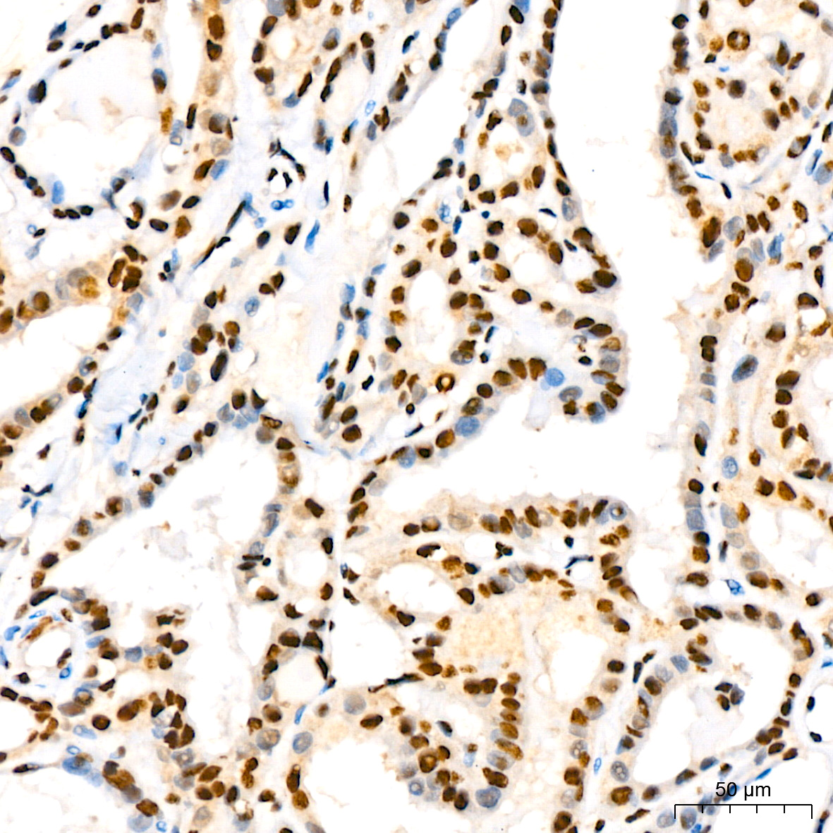 Phospho-IκBα-S36 Rabbit mAb