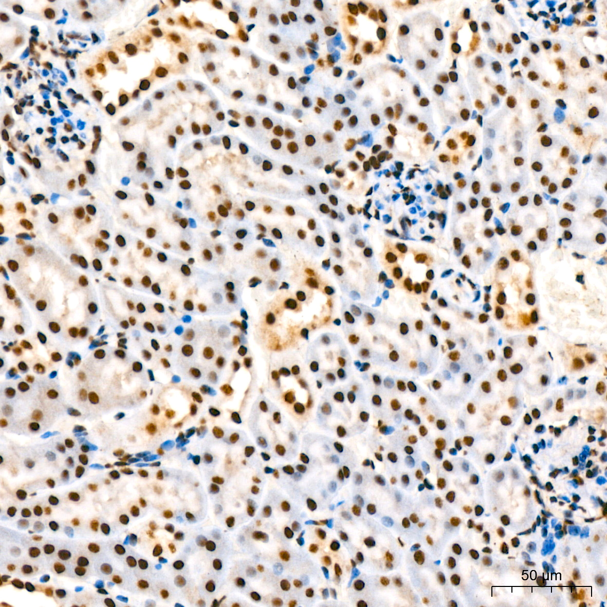 Phospho-IκBα-S36 Rabbit mAb