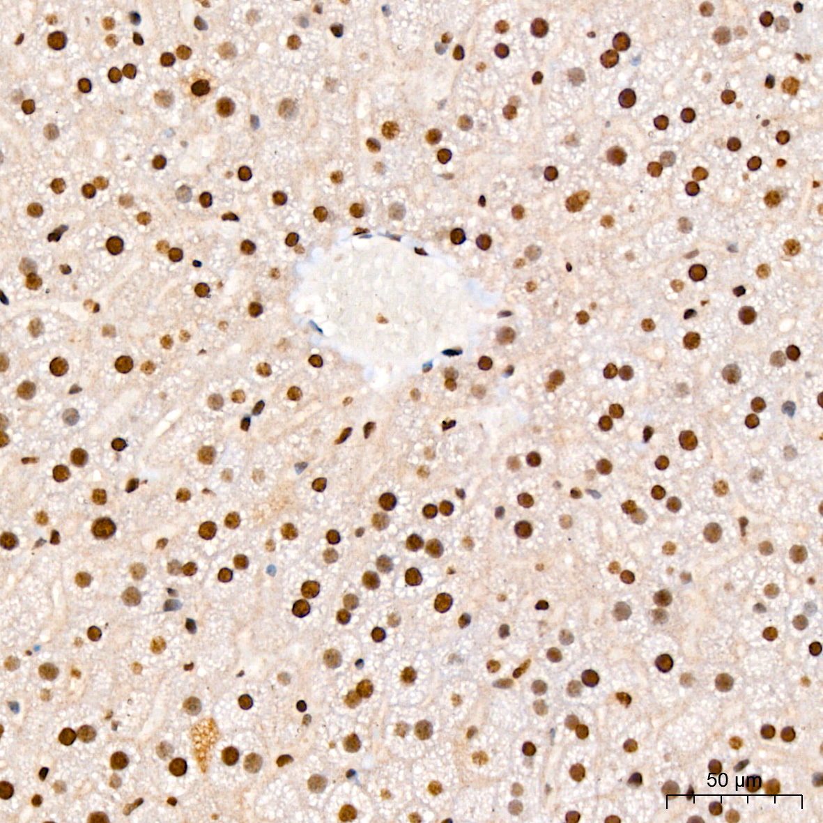 Phospho-IκBα-S36 Rabbit mAb