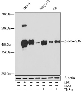 Phospho-IκBα-S36 Rabbit mAb