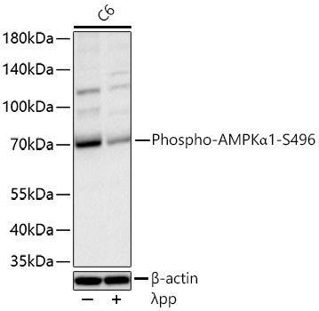 Phospho-AMPKα1-S496 Rabbit mAb
