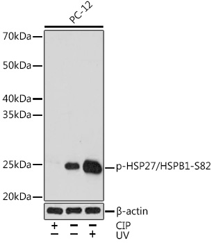 Phospho-HSP27/HSPB1-S82 Rabbit mAb