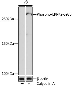 Phospho-LRRK2-S935 Rabbit mAb
