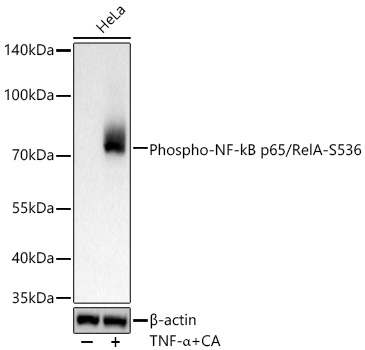 Phospho-NF-kB p65/RelA-S536 Rabbit mAb