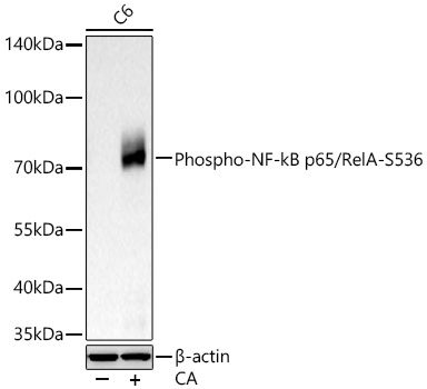 Phospho-NF-kB p65/RelA-S536 Rabbit mAb