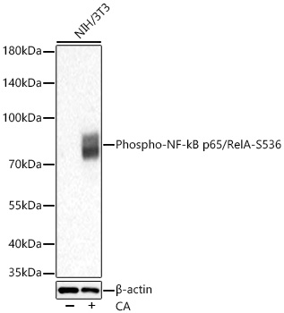 Phospho-NF-kB p65/RelA-S536 Rabbit mAb